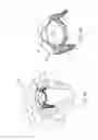 Fig. 10 - Valve prosthesis and method for delivery