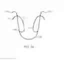 Fig. 20 - Valve prosthesis and method for delivery
