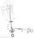 Fig. 01 - Trans-apical implant systems, implants and methods