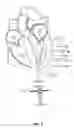 Fig. 06 - Trans-apical implant systems, implants and methods