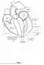 Fig. 08 - Trans-apical implant systems, implants and methods