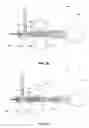 Fig. 18 - Trans-apical implant systems, implants and methods
