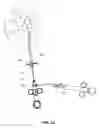 Fig. 19 - Trans-apical implant systems, implants and methods