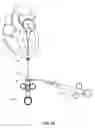 Fig. 21 - Trans-apical implant systems, implants and methods