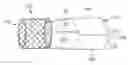 Fig. 01 - Method for treating a mitral valve