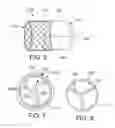 Fig. 04 - Method for treating a mitral valve