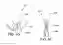 Fig. 06 - Method for treating a mitral valve