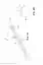 Fig. 03 - Penile prosthetic insert with a body having a channel and a method for implantation of a penile prosthetic