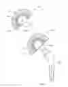Fig. 02 - REVISION HIP IMPLANTS AND PROSTHESIS SYSTEMS