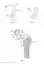 Fig. 03 - REVISION HIP IMPLANTS AND PROSTHESIS SYSTEMS