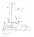Fig. 01 - Implants for fixation of the distal tibia