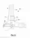 Fig. 07 - Implants for fixation of the distal tibia