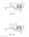 Fig. 07 - Expandable interbody fusion device