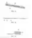Fig. 10 - Expandable interbody fusion device