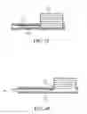Fig. 15 - Expandable interbody fusion device