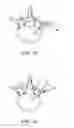 Fig. 18 - Expandable interbody fusion device