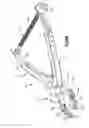 Fig. 09 - Intervertebral implants, systems, and methods of use