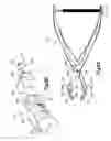 Fig. 10 - Intervertebral implants, systems, and methods of use