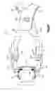 Fig. 11 - Intervertebral implants, systems, and methods of use