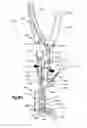 Fig. 23 - Intervertebral implants, systems, and methods of use
