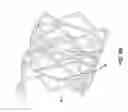 Fig. 21 - BIOABSORBABLE POLYMERIC MEDICAL DEVICE