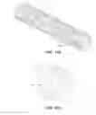 Fig. 32 - BIOABSORBABLE POLYMERIC MEDICAL DEVICE