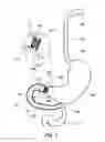 Fig. 02 - Delivery devices and methods for gastrointestinal implants