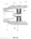 Fig. 17 - Delivery devices and methods for gastrointestinal implants