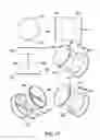 Fig. 28 - Delivery devices and methods for gastrointestinal implants