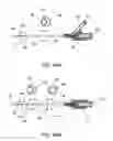 Fig. 45 - Delivery devices and methods for gastrointestinal implants