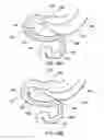 Fig. 51 - Delivery devices and methods for gastrointestinal implants