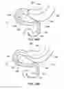 Fig. 56 - Delivery devices and methods for gastrointestinal implants