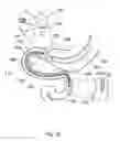 Fig. 57 - Delivery devices and methods for gastrointestinal implants
