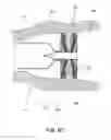 Fig. 62 - Delivery devices and methods for gastrointestinal implants