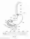 Fig. 63 - Delivery devices and methods for gastrointestinal implants