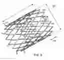 Fig. 07 - Intestinal sleeve