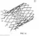 Fig. 11 - Intestinal sleeve