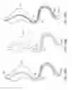 Fig. 46 - Intestinal sleeve