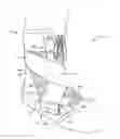 Fig. 01 - Ankle support
