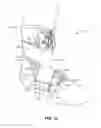 Fig. 02 - Ankle support