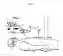 Fig. 15 - Laser system for eye surgery