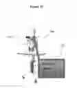 Fig. 26 - Laser system for eye surgery