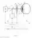 Fig. 06 - Method for Alignment of Intraocular Lens