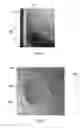 Fig. 08 - Method for Alignment of Intraocular Lens