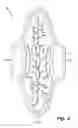 Fig. 03 - Absorbent article demonstrating controlled deformation and longitudinal fluid distribution