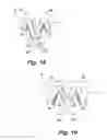 Fig. 17 - ABSORBENT ARTICLE DEMONSTRATING CONTROLLED DEFORMATION AND LONGITUDINAL FLUID DISTRIBUTION