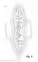 Fig. 04 - Absorbent article demonstrating controlled deformation and longitudinal fluid distribution