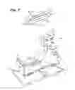 Fig. 12 - Absorbent article demonstrating controlled deformation and longitudinal fluid distribution