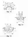 Fig. 15 - Absorbent article demonstrating controlled deformation and longitudinal fluid distribution