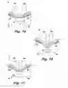 Fig. 16 - Absorbent article demonstrating controlled deformation and longitudinal fluid distribution